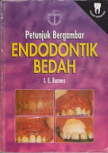 Petunjuk Bergambar Endodontics Bedah = Surgical Endodontics: Colour Manual